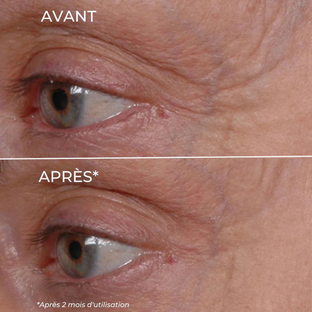 White Tea Eye Contour - LEONIA