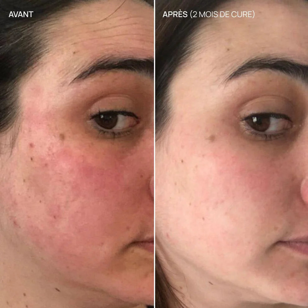 Kaki beaute AIME French Glow
