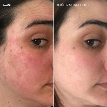 Kaki beaute AIME French Glow