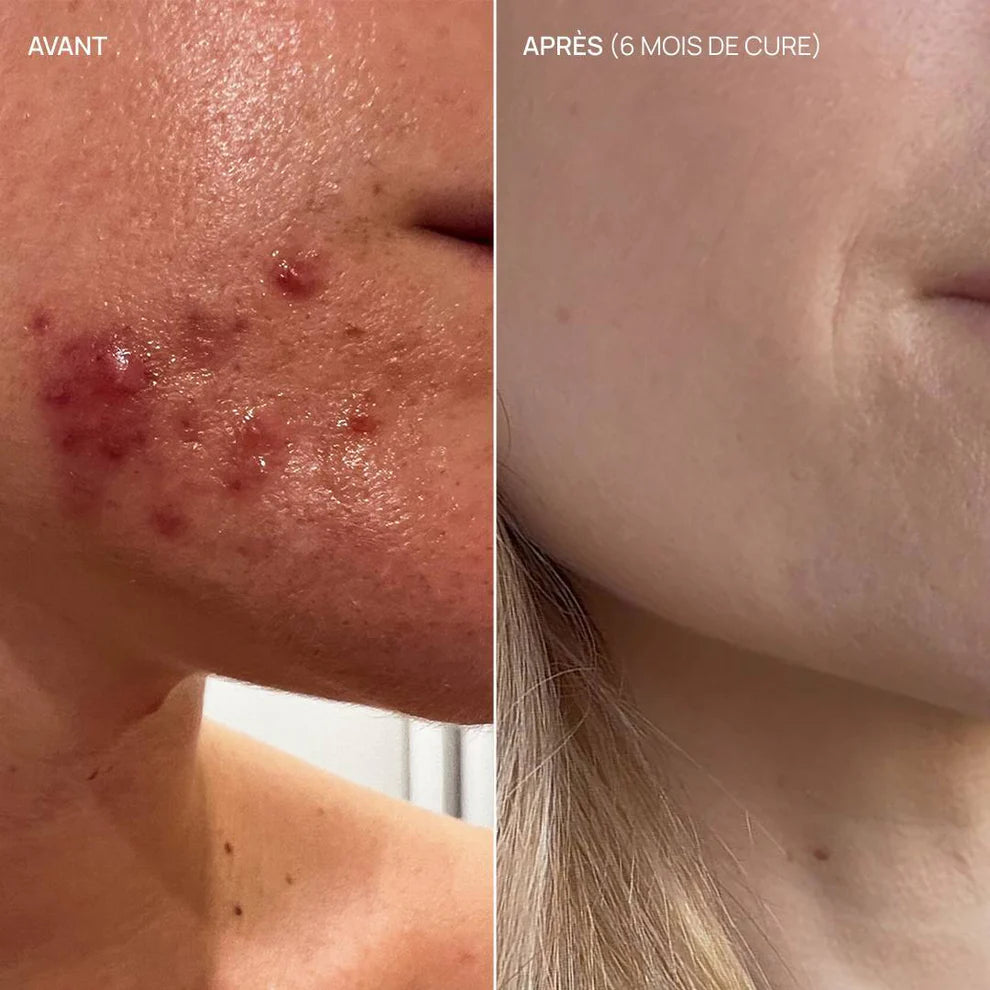 Complément Alimentaire Pure Glow 04 - AIME | KAKI BEAUTÉ