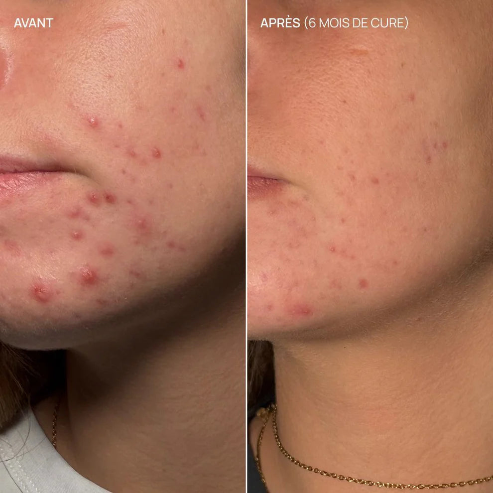 Complément Alimentaire Pure Glow 06 - AIME | KAKI BEAUTÉ