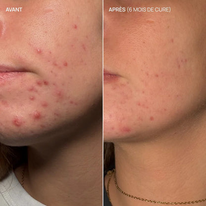 Complément Alimentaire Pure Glow 06 - AIME | KAKI BEAUTÉ